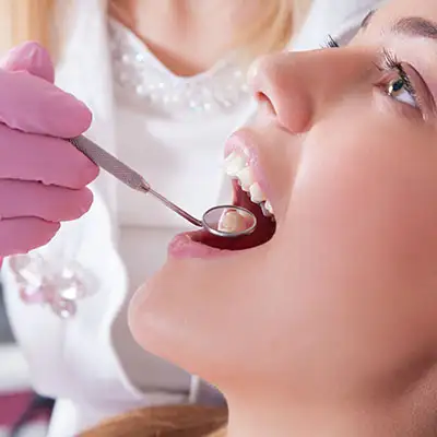 Teeth Whitening
