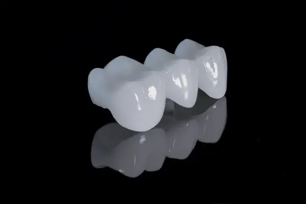 dental bridges in north port fl