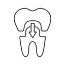 dental crowns north port fl