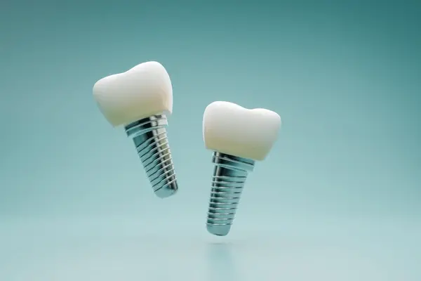 dental implants in north port fl