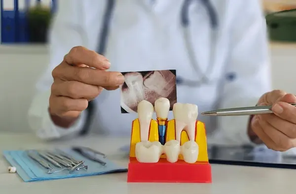 dental implants near you