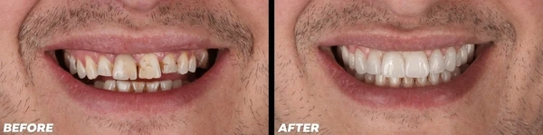 smile makeover near you